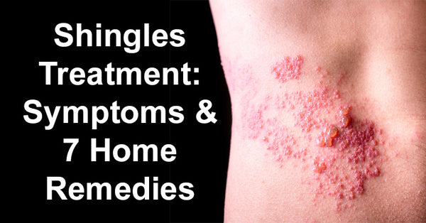 Shingles Treatment: Symptoms & 7 Home Remedies For Shingles - David 