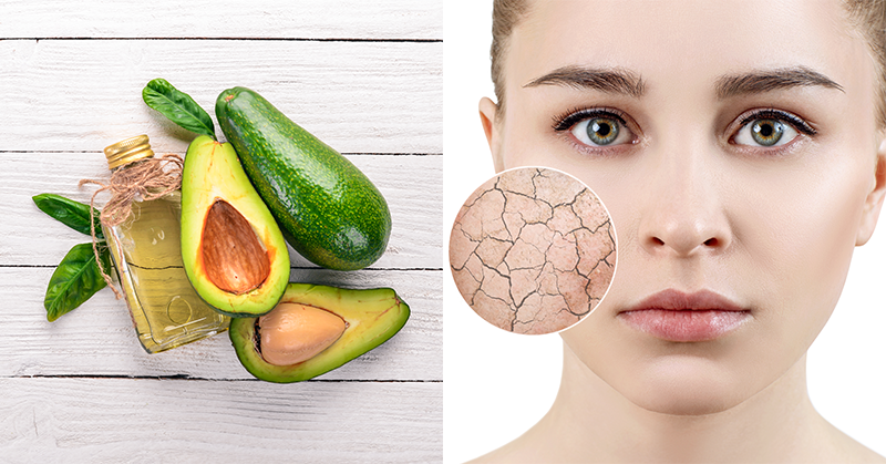 Got Dry Skin? Here's Why You NEED Avocado Oil!
