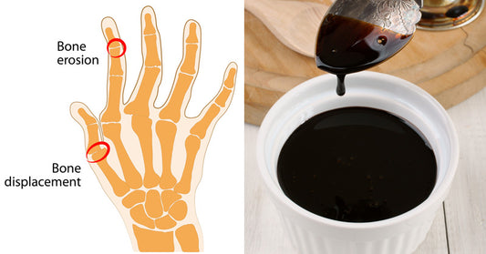 Blackstrap Molasses: 9 Health Benefits