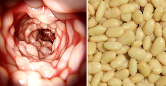 Cannellini Beans: 6 Benefits & Uses