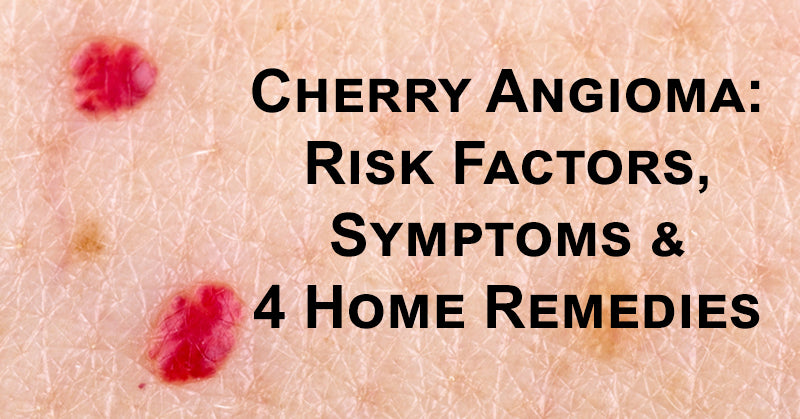 Cherry Angioma FI