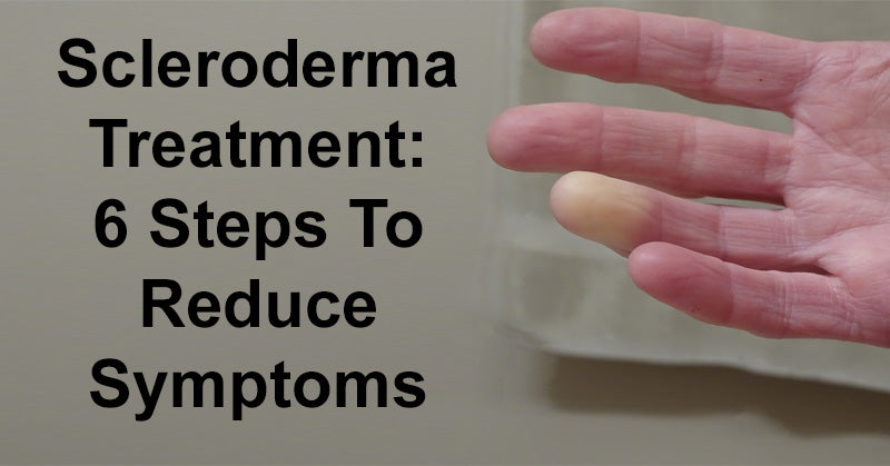 Scleroderma Treatment: 6 Steps To Reduce Symptoms