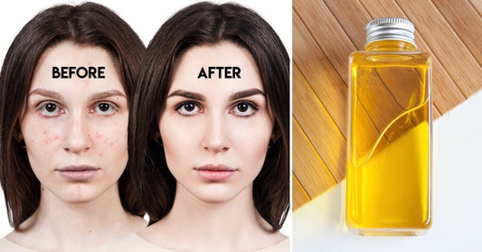 Argan Oil: 12 Surprising Beauty Uses