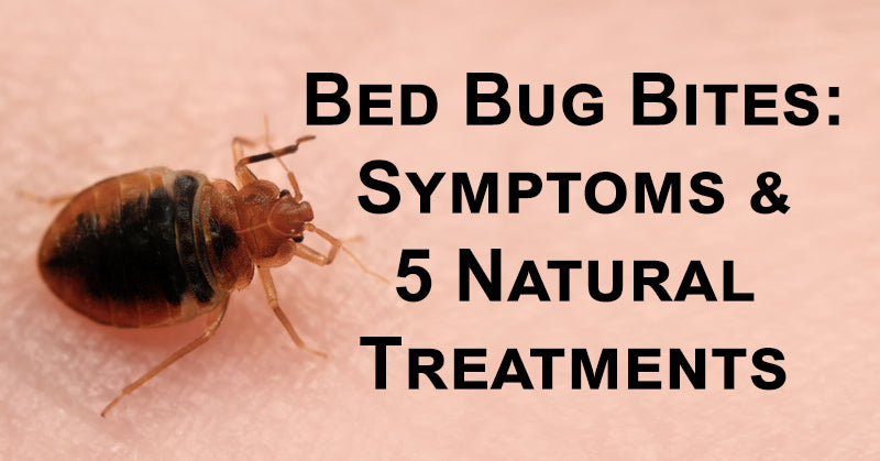 bed bug bites FI