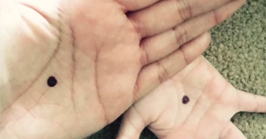 black dot palm FI