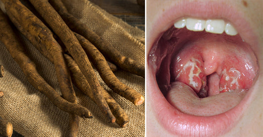 9 Burdock Root Benefits & Uses