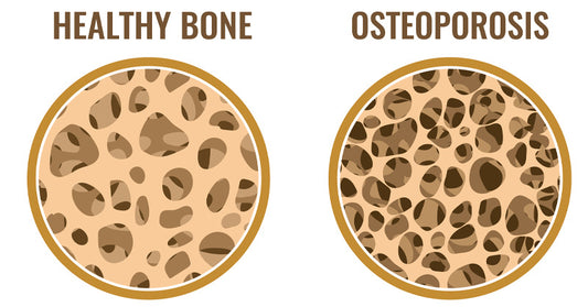 calcium deficiency calcium health benefits FI