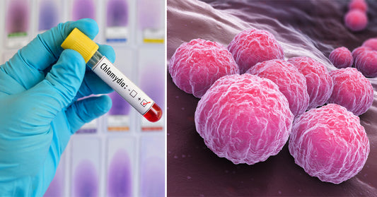 chlamydia symptoms FI