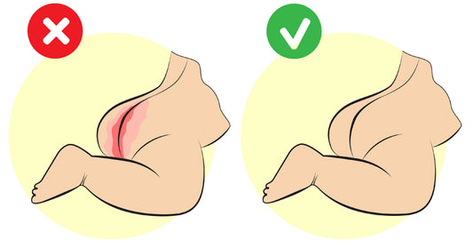 diaper rash treatment FI