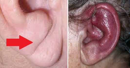 ear health FI