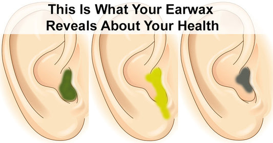This Is What Your Earwax Reveals About Your Health