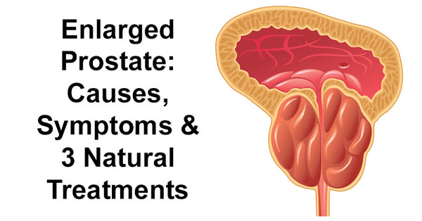 Enlarged Prostate: Causes, Symptoms & 3 Natural Treatments - David ...