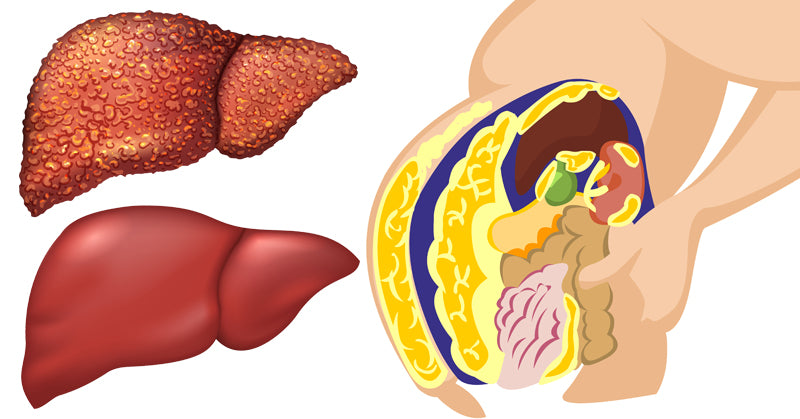 food liver detox FI