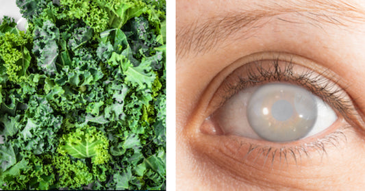 Kale: 7 Health Benefits