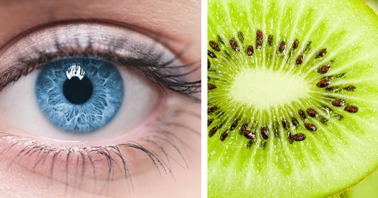 Kiwi: 10 Health Benefits