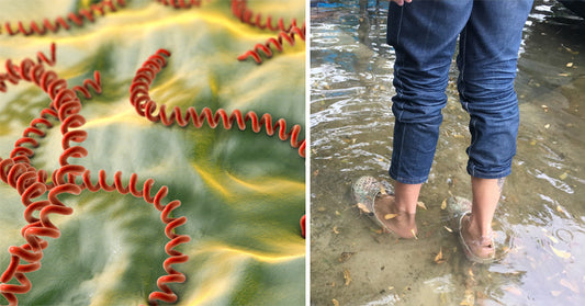 Leptospirosis Symptoms & 6 Steps To Prevent It