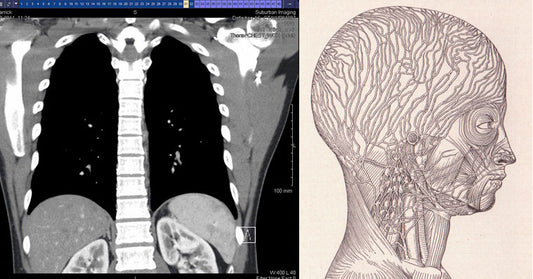 lymphatic system xray FI