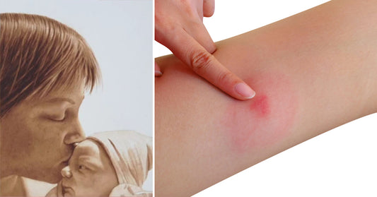 mother spider bite FI