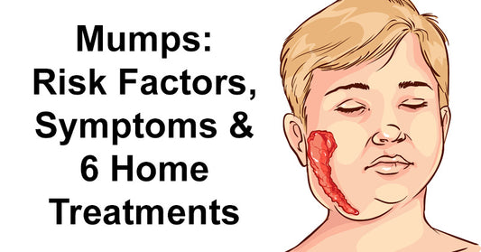Mumps: Risk Factors, Symptoms & 6 Home Treatments