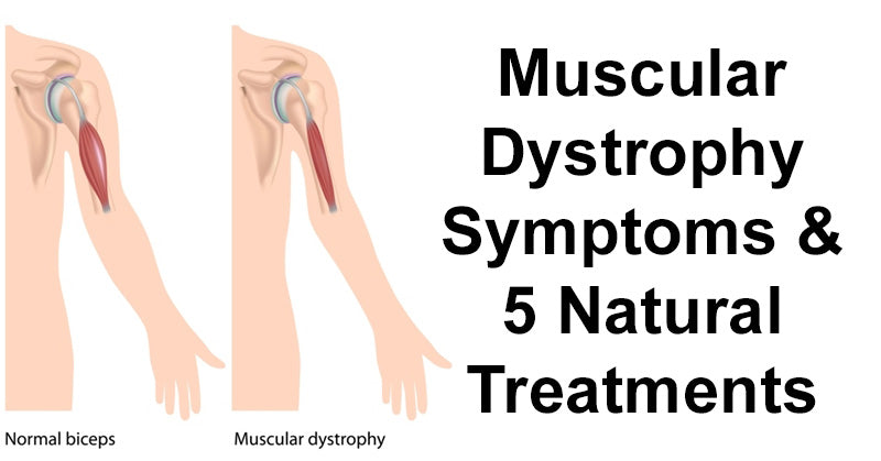 Muscular Dystrophy: Symptoms & 5 Natural Treatments