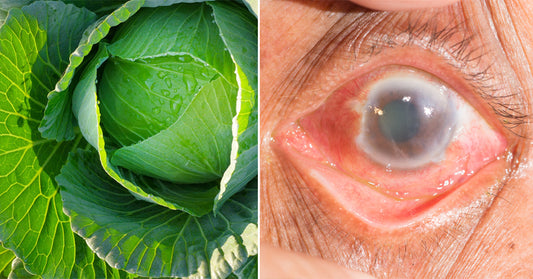 plants glaucoma FI