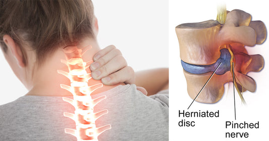 slipped disk FI