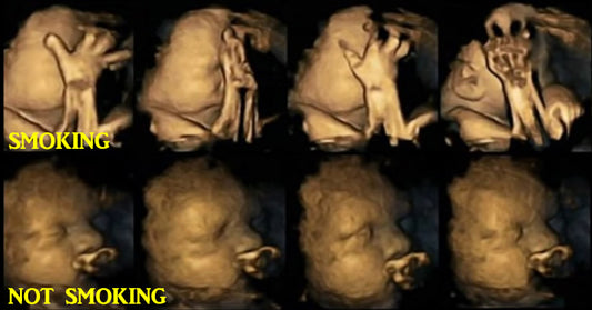 smoking pregnant FI