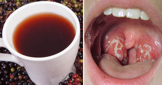 strep remedies FI