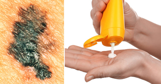sunscreen dangers FI