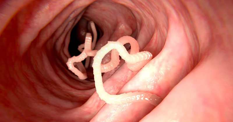 tapeworms FI