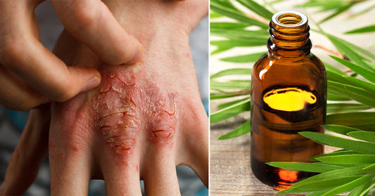 tea tree essential oil FI