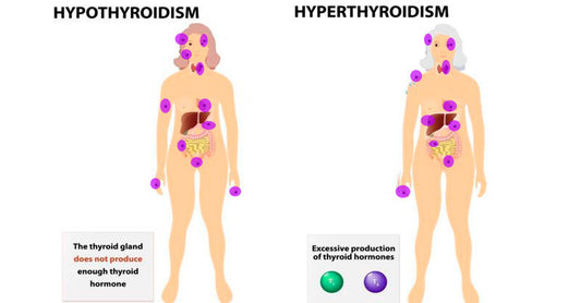 thyroid-issues